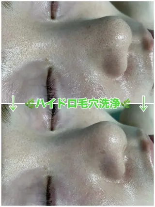 脱毛&美容サロン Dr.Epiのエステ・リラクイメージ