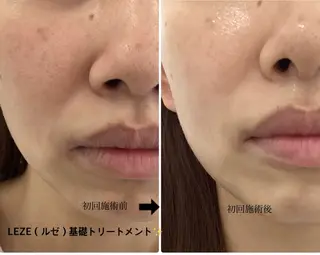 🩵Tatsumi Kana🩵のエステ・リラクイメージ