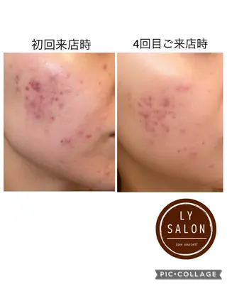 LY SALON所属・LY　SALON♡ トータルビューティーのエステ・リラクイメージ