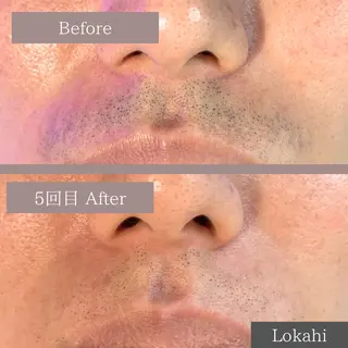 メンズ Lokahi所属・リラク/エステ Lokahiのエステ・リラクイメージ