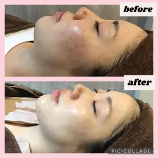 エヴァーグレース 河原町店のエステ・リラクイメージ