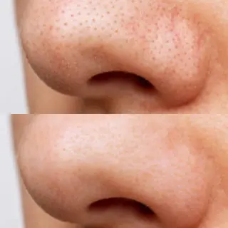 プライベートサロンBRAG所属・プライベートサロン BRAG🏠男女OKのエステ・リラクイメージ