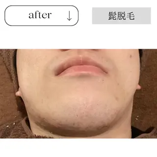 beauty CHOOSEのマツエク・マツパデザイン