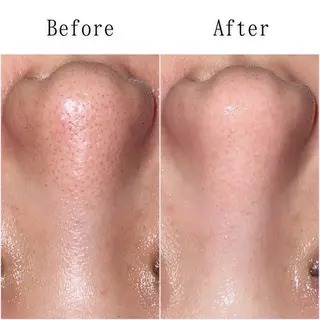 シミ・毛穴専門店 gracia 宇土店所属・シミ・毛穴専門店 /gracia 安藤のエステ・リラクイメージ