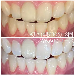 メンズ ホワイトニングルーム　川崎店所属・ホワイトニング ルーム　川崎店のその他イメージ