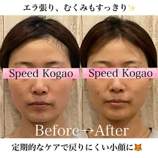 渋谷小顔矯正 毛穴洗浄ウミのエステ・リラクイメージ