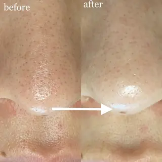 毛穴専門サロン　フルール所属・フルールFululu 自由が丘のエステ・リラクイメージ