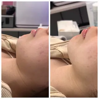 本気で痩せたい方へ 痩身専門サロンのエステ・リラクイメージ