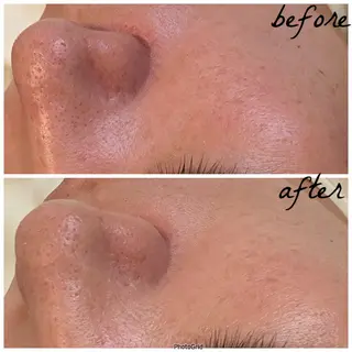 メンズ メナード岐阜市茜部 杉浦のエステ・リラクイメージ