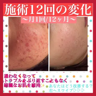 ミディアム カラー パーマ ヘアアレンジ メンズ キッズ ネイル マツエク・マツパ アイブロウ ニキビ・肌質改善専門 ♡人生が変わるサロンのエステ・リラクイメージ