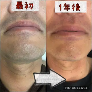 メンズ トータルビューティーサロン LilyRose所属・エステサロン LilyRoseのエステ・リラクイメージ