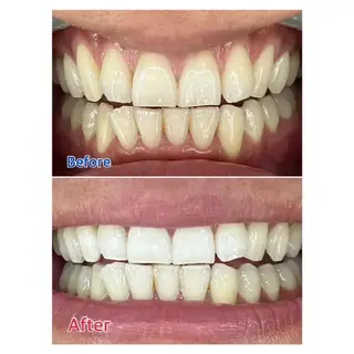 M渋谷店所属・Ｍ渋谷 ホワイトニングのエステ・リラクイメージ