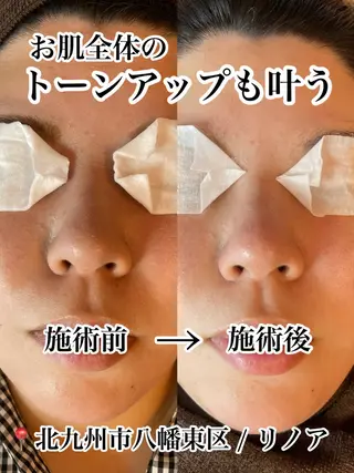 Private salon Linoa所属・プライベートサロン Linoaのマツエク・マツパデザイン