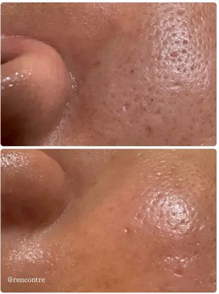 トータルビューティーサロン ランコントル難波所属・rencontre Kahoのエステ・リラクイメージ