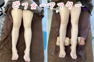 さくらんぼ鍼灸院所属・美容鍼&温活・免活 さくらんぼ鍼灸院のエステ・リラクイメージ