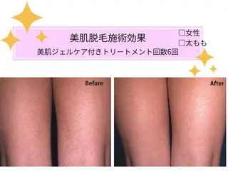 VIKI BEAUTY  クレイハーブピーリング・美肌脱毛専門店所属・VIKI BEAUTYのエステ・リラクイメージ