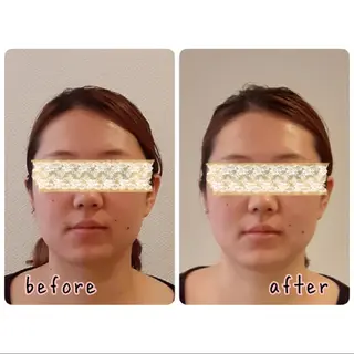 女性専門 Luna time 整体院所属・Luna time  整体院　金子ゆかのエステ・リラクイメージ