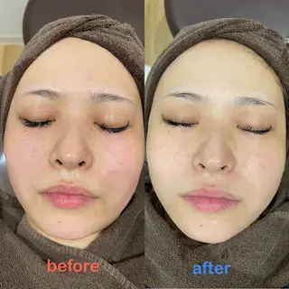 vary  clue MISAのエステ・リラクイメージ