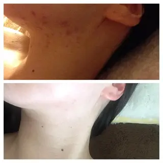 Leading Ladiesのエステ・リラクイメージ