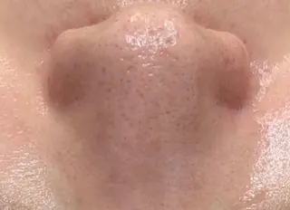 東京ビューティー 五反田店　nanaのエステ・リラクイメージ