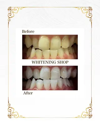 ホワイトニングショップ静岡葵区店所属・ホワイトニング ショップ葵区静岡駅店のその他イメージ