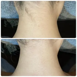 メンズ&レディース美容脱毛専門LEPIAつくば店所属・廣木 麻衣子のエステ・リラクイメージ