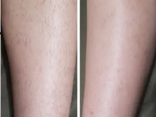 脱毛専門減毛サロン LULU.tokyoのエステ・リラクイメージ