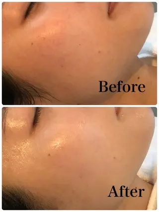 デ・アイム吹田サロン所属・垣内 賀奈子のエステ・リラクイメージ