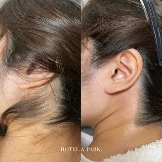 HOTEL&PARK . ワックス脱毛のエステ・リラクイメージ