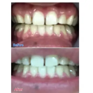 M渋谷店所属・M渋谷 ホワイトニングのその他イメージ