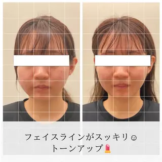 美容鍼/ヘッドスパ/ 💎さかもとのエステ・リラクイメージ