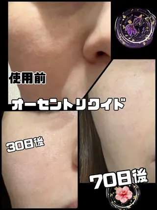 【安心ハンドテク】 メナード富田丘のエステ・リラクイメージ