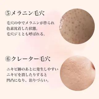 ハーブピーリング専門 muro.のエステ・リラクイメージ