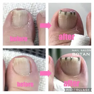 ネイル NAIL SALON BOTANのネイルデザイン