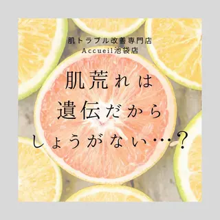 ニキビ・肌質改善専門 ♡人生が変わるサロンのエステ・リラクイメージ