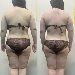 ハイパーナイフ専門店 Salon de COCO所属・Salon de COCOのエステ・リラクイメージ