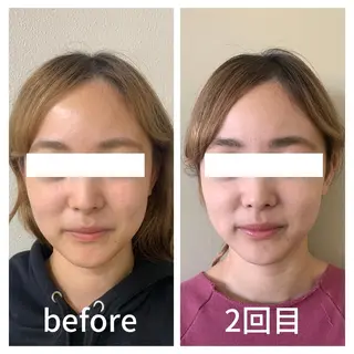 小顔サロン AMYONのエステ・リラクイメージ