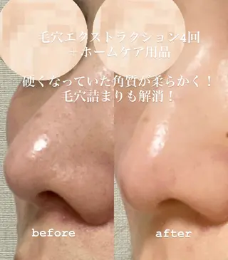 クレアス勝どき・肌質改善専門店【CREAS Beauty Salon】所属・クレアス勝どき【毛穴 ハーブピーリング専門のエステ・リラクイメージ