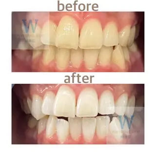 ホワイトニング ショップ船橋２号店のエステ・リラクイメージ