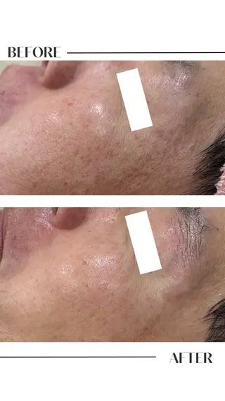 フェイシャル/脱毛 ジョアアンジェ　田中のエステ・リラクイメージ