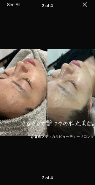 メディカルエステサロンir アイアール所属・韓国肌管理　肌質改善 irのエステ・リラクイメージ