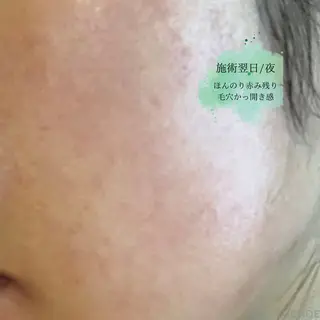 肌質改善 KALANCHOEのエステ・リラクイメージ