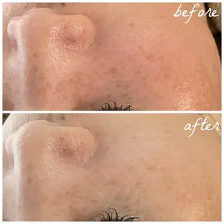 メンズ メナード岐阜市茜部 杉浦のエステ・リラクイメージ