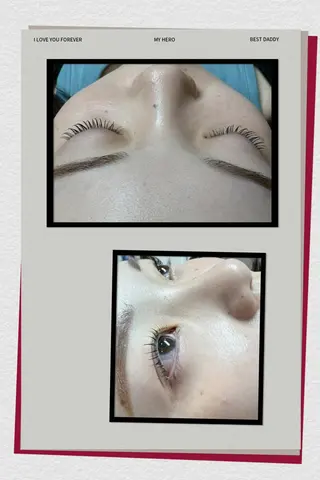 マツエク・マツパ Alice マツエク&ネイル2のネイルデザイン