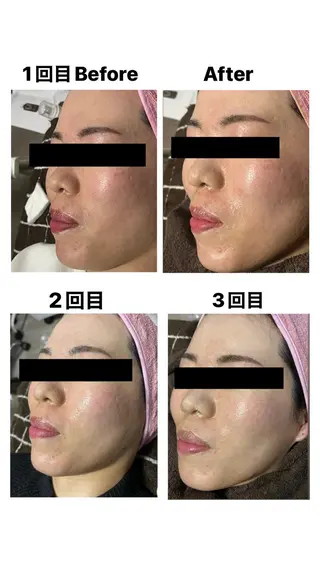 Lash-bar   kanoa所属・Lash-bar kanoaのエステ・リラクイメージ