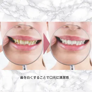 ホワイトニングショップ津店所属・ホワイトニング ショップ津店のその他イメージ