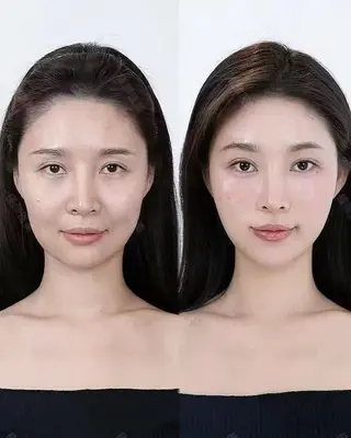 マツエク・マツパ aliaハイフ&水光ジェットサロン所属・aliaハーブ水光店 エステティシャン募集のエステ・リラクイメージ