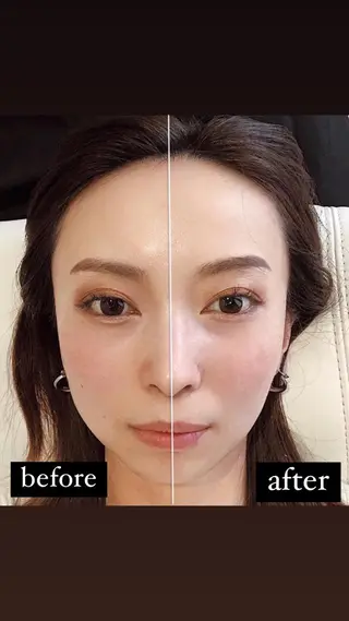 脱毛美容サロン1st ピーリング/ワックスのエステ・リラクイメージ