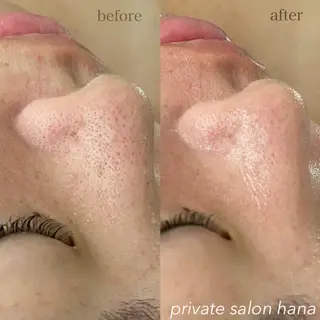 private salon hanaのエステ・リラクイメージ