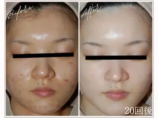 MYubelle ミューベルのエステ・リラクイメージ